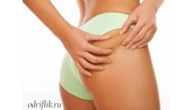 Антицеллюлитный массаж Антицеллюлитный массаж