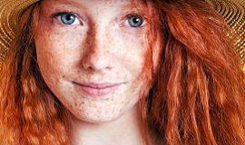 Как избавиться от веснушек и пигментных пятен Как избавиться от веснушек и пигментных пятен м