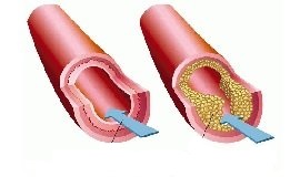 Полезные продукты для сосудов и сердца Сосуды и сердце как питаться м