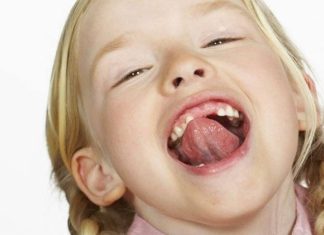 Пластика уздечки языка у детей: на что влияет длина уздечки языка, чем опасно оставить ее без внимания и какие симптомы у короткой уздечки