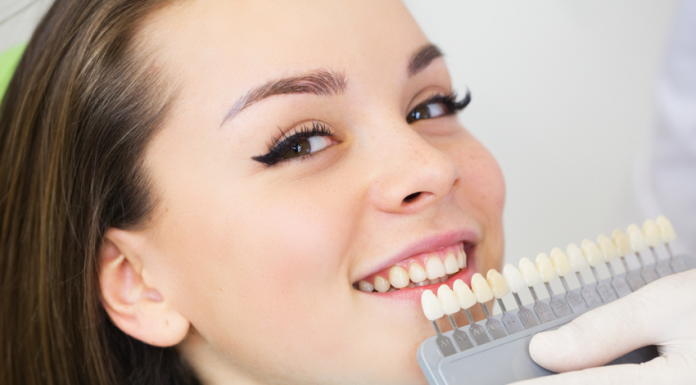 Отбеливание зубов в Алматы: какие современные технологии для него применяют