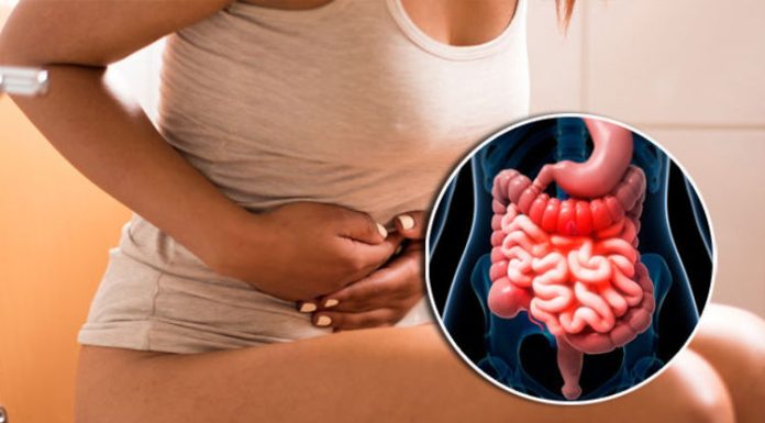 Колит кишечника: симптомы, диета