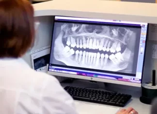 КТ челюсти: что это такое и кому ее делают