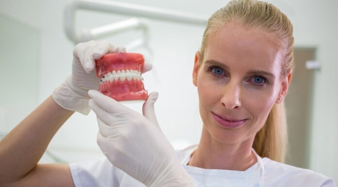 Виниры: что это такое, для чего нужны, как они могут изменить внешний вид зубов