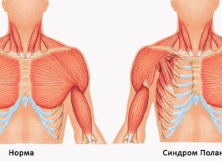 Патологии грудной клетки у детей