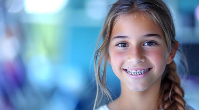 Элайнеры или брекеты: что лучше для ребенка