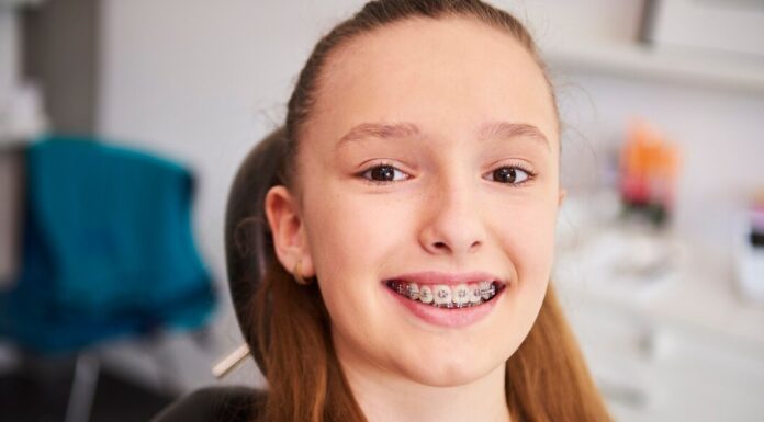 Чем безлигатурные брекеты лучше классических