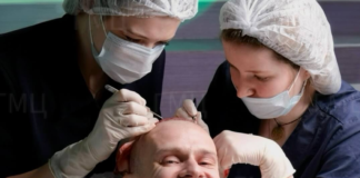 Клиника по пересадке волос в Москве: цены, отзывы и советы врачей 2025