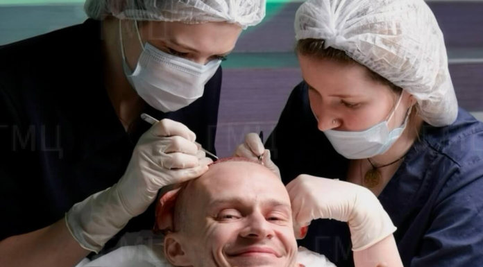 Клиника по пересадке волос в Москве: цены, отзывы и советы врачей 2025